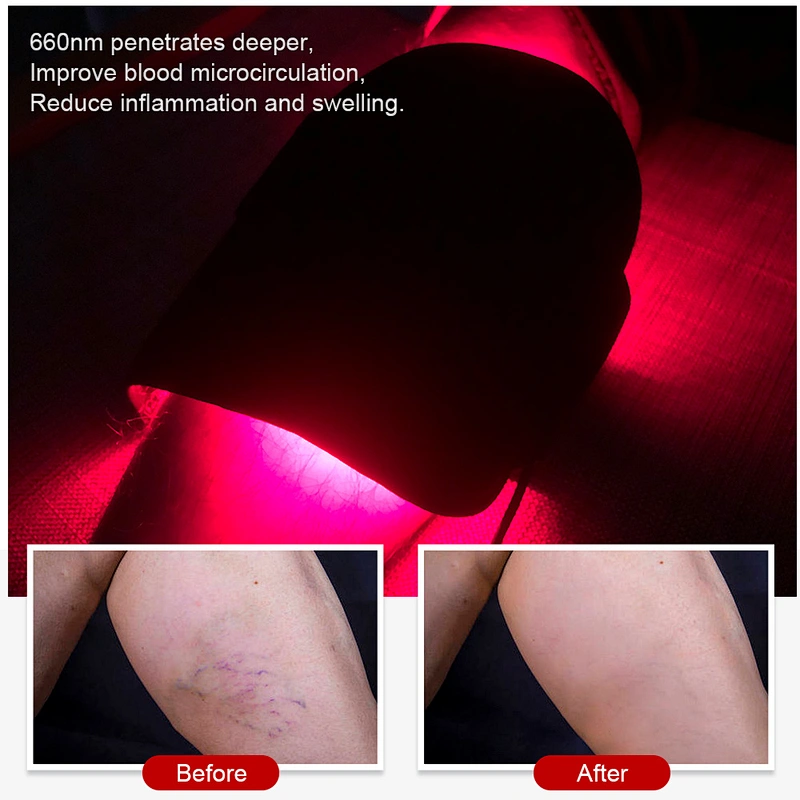 Red Infrared Light Therapy Belt for body pain relief
